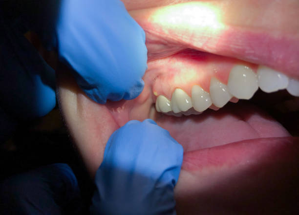 Best Tooth Infection Emergency Dentist  in Quincy, IL