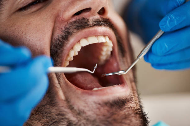Best Broken Tooth Emergency  in Quincy, IL
